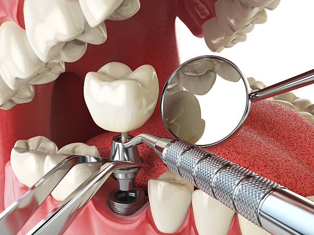 Best Broken or Cracked Tooth Emergency Dentist in Haines, AK